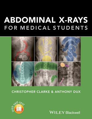 Abdominal-X-rays-for-Medical-Students