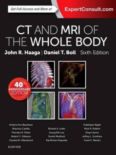 Ebook CT-and-MRI-of-the-Whole-Body-2-Volume-Set-6e