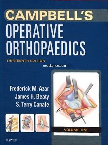 Ebook Campbells-Operative-Orthopaedics-4-Volume-Set-13e