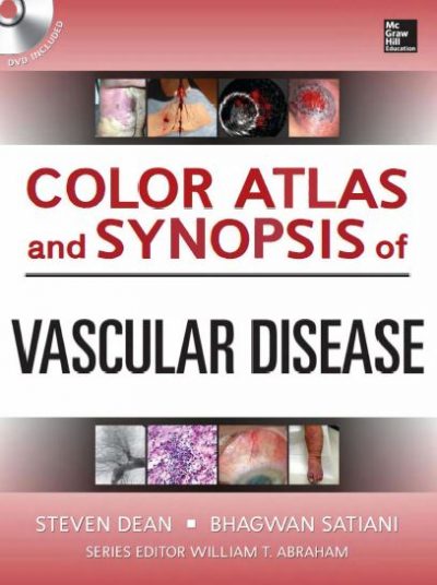 Ebook Color-Atlas-and-Synopsis-of-Vascular-Disease-1e