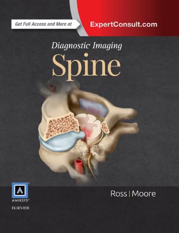 Ebook Diagnostic-Imaging-Spine-3rd-Edition