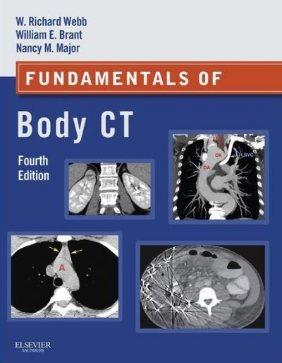 Ebook Fundamentals-of-Body-CT-4e
