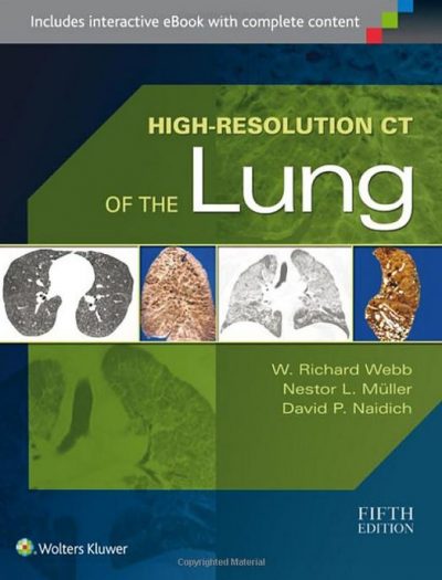Ebook High-Resolution-CT-Lung-Richard-Webb
