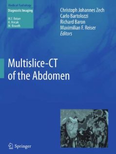 Ebook Multislice-CT-of-the-Abdomen