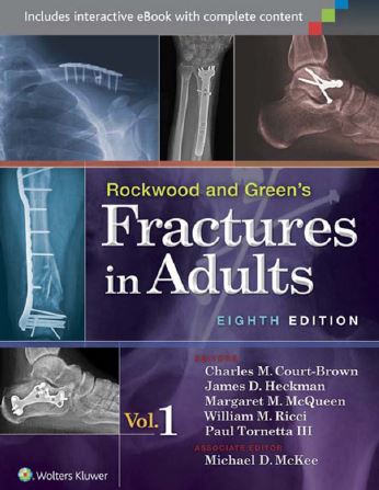 Ebook Rockwood-and-Greens-Fractures-in-Adults-8th-Edition
