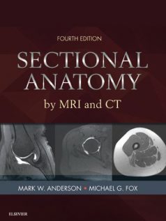 Ebook Sectional-Anatomy-by-MRI-and-CT-4th-Edition