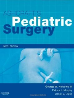 Ebook Ashcrafts-Pediatric-Surgery-6th-Edition