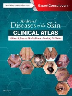 Andrews-Diseases-of-the-Skin-Clinical-Atlas