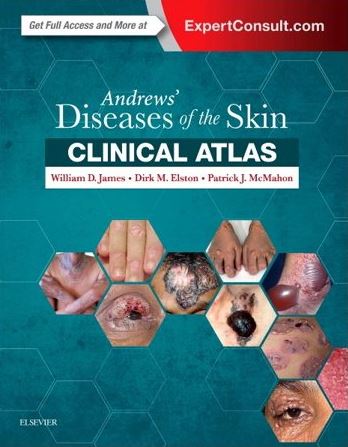 Andrews-Diseases-of-the-Skin-Clinical-Atlas