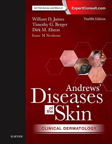 Andrews-Diseases-of-the-Skin-Clinical-Dermatology-12e