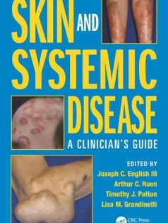 Skin-and-Systemic-Disease