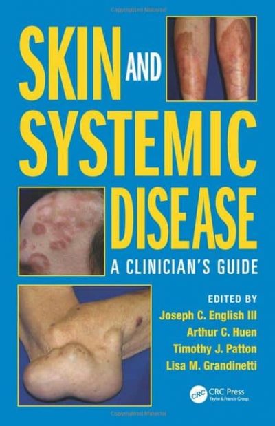 Skin-and-Systemic-Disease
