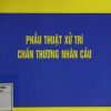 phau-thuat-xu-tri-chan-thuong-nhan-cau