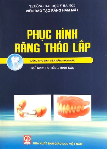 phuc-hinh-rang-thao-lap-tong-minh-son
