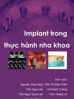 Implant trong thực hành nha khoa