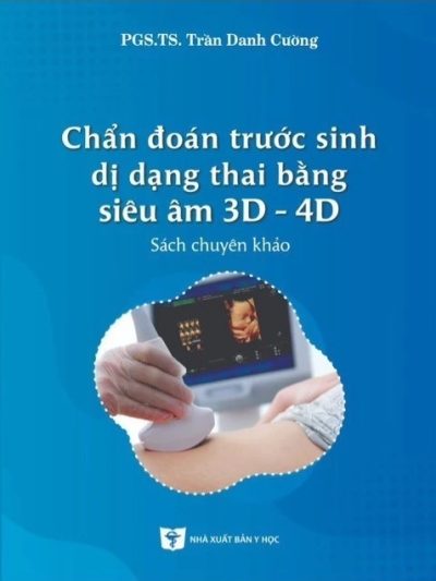 Chẩn đoán trước sinh dị dạng thai