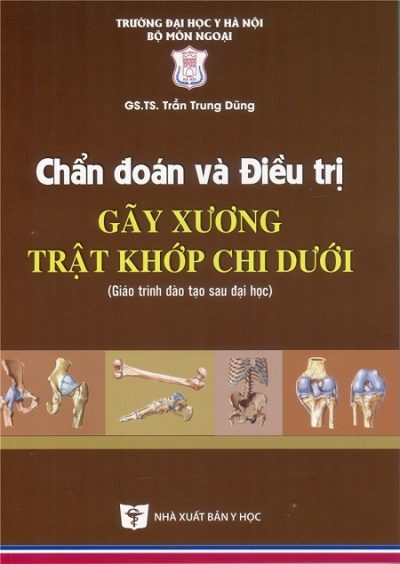 Chẩn Đoán Và Điều trị GÃY XƯƠNG, TRẬT KHỚP CHI DƯỚI