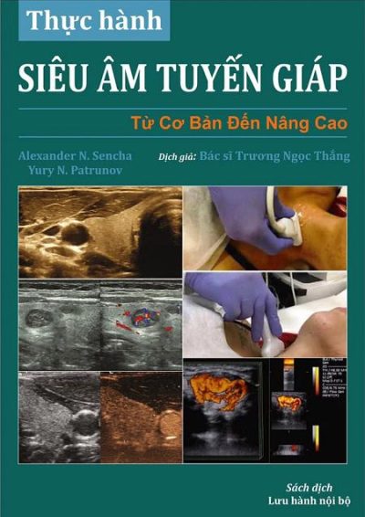 Thực hành siêu âm tuyến giáp từ cơ bản đến nâng cao